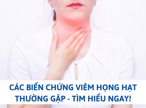 Các biến chứng viêm họng hạt thường gặp - Tìm hiểu ngay!